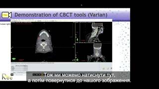 Session 11  IGRT ImageMatching Workshop in CBCT [upl. by Nance544]