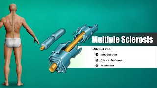 Multiple sclerosis  causes symptoms diagnosis treatment pathology [upl. by Clari]