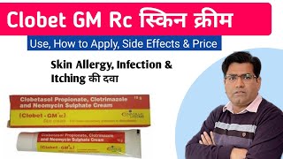 Clobet GM RC Cream Use Benefits Composition Side Effects and Price in Hindi [upl. by Michi]