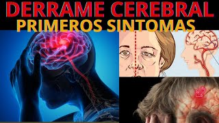 🧠8 Señales de alerta de un Derrame Cerebral ¿Sabes reconocerlas [upl. by Atsirtal]