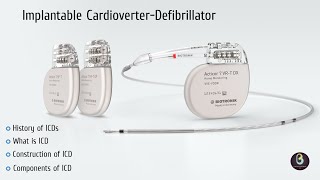 Implantable Cardioverter Defibrillator  ICD  Biomedical Engineers TV [upl. by Maccarone514]