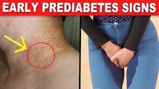 9 Early PREDIABETES Warning Signs Youre Unaware Of [upl. by Etnovad183]