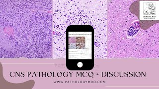 CNS Pathology MCQs  Discussion [upl. by Lytsirk979]