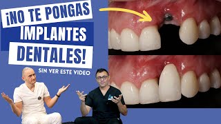 ¡No te pongas un Implante Dental sin ver este video [upl. by Klenk293]