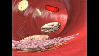 PLAVIX® clopidogrel Mechanism of Action  ADPDependent Platelet Aggregation [upl. by Ettenowtna]