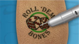 DÖVME SİLDİRME  AdenoidectomyampTattoo Removal [upl. by Scarlet]