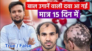 Indian Hair Products for Hair Growth  Salman Mandoli Exposed hair hairlosstreatment [upl. by Adnoloy]