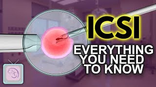 IVF ICSI Procedure  Important things you need to know [upl. by Ahsiet95]