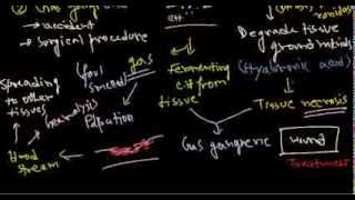 Clostridium perfringens infection and pathogenesis [upl. by Buchanan]