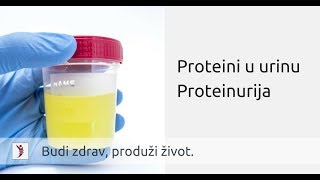 Proteini u urinu mokraći • Proteinurija [upl. by Elyagiba]