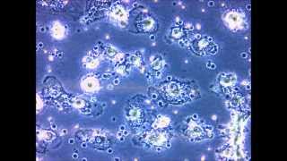 hepatocyte produced from human leukocytes via retrodifferentiation [upl. by Hymen687]