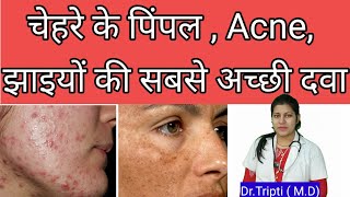 Berberis aquifoliumMedicine for acnepigmentationscars berberisaquifolium shorts acne  pimple [upl. by Nired609]