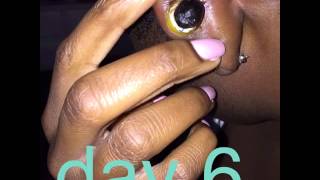 Keloid Removal Rubber Band Process [upl. by Corette]