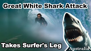 Shark Attack Takes Surfers Leg Kai McKenzie Australian Shark Attacks [upl. by Anoy36]