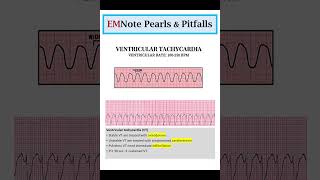 ACLS Cardiac Arrhythmias [upl. by Nerrual876]