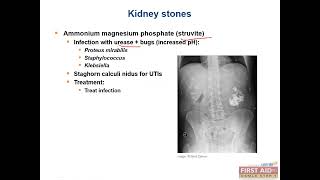 Kidney stones or Nephrolithiasis Renal pathology video part4 from USMLE First Aid Step One [upl. by Enialahs]