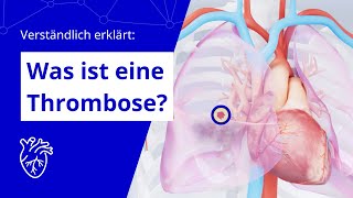 Verständlich erklärt Was ist eine Thrombose [upl. by Savannah]