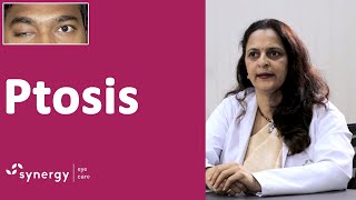 What is ptosis Ptosis Causes and Treatment [upl. by Wolfy]