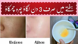 Winter Skin Care Routine  Homemade Face Oil For Glowing Skin In 3 Days [upl. by Young]