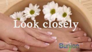 Bunion pain relief massage [upl. by Andreas691]