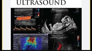 Ultrasound  Applications of Ultrasound Ultrasonography  Echocardiography  Physics Class 9th [upl. by Ennovehs]