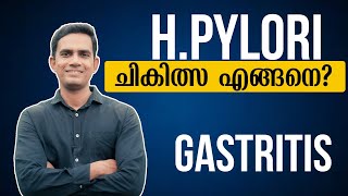 Hpylori ചികിത്സ എങ്ങനെ  Dr Sijil K S [upl. by Sollars585]