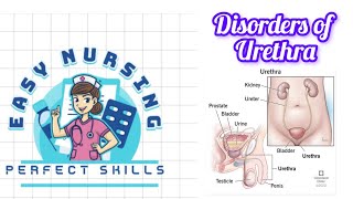 Disorders of urethra4th sem [upl. by Lohse]