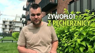 Rośliny na żywopłot  pęcherznica [upl. by Stedman]