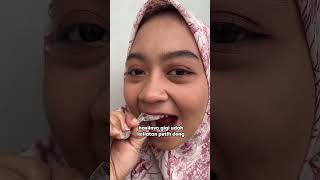 Bye Gigi Kuning smileexpert teethwhiteningstrips pemutihgigi [upl. by Becka126]