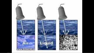 Ultrasound Basics [upl. by Neerak]