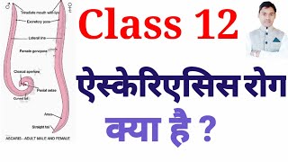 ascariasis disease class 12 ऐस्कैरिएसिस रोग vedio 100 [upl. by Llemaj]