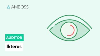 Differentialdiagnostik des Ikterus  AMBOSS Auditor [upl. by Mesics]