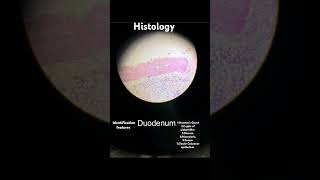 ANATOMY  HISTOLOGY  DUODENUM  IDENTIFICATION FEATURES mbbs anatomy medstudent life doctor [upl. by Oinoitna]