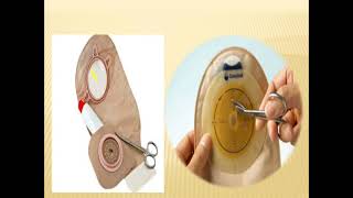 colostomy care procedure [upl. by Danell]