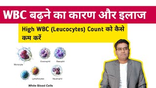 WBC बढ़ने का कारण और ईलाज  High WBC Leucocytes Count Causes and Treatment [upl. by Shantha283]