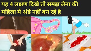 ये 4 लक्षण बताते है कि महिला मे अंडे नही बन रहे है। Anovulation symptoms in hindi। [upl. by Larrisa]