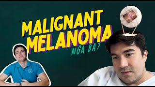 CANCEROUS BA ANG NUNAL NI LUIS MANZANO [upl. by Ativak295]