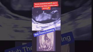 Baby Abdominal pain due to mother wrong sleep position😭viralvideo trending viralshorts [upl. by Anilesor666]