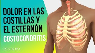 Costocondritis  Sindrome costoesternal  Sindrome de Tietze [upl. by Keynes]