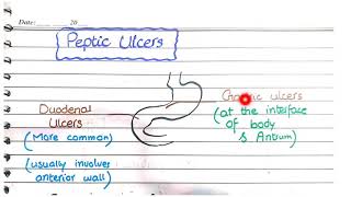 Peptic Ulcer Disease  Morphology [upl. by Bernj]