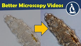 Better microscopy videos by improving contrast 🔬 Amateur Microscopy [upl. by Lorilyn651]