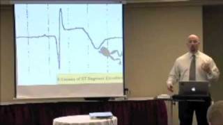 The 6 Causes ST Segment Elevation on an EKG ECG [upl. by Nylirad154]