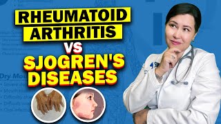 The Hidden Connection Between Rheumatoid Arthritis and Sjogrens Syndrome [upl. by Nyllek]