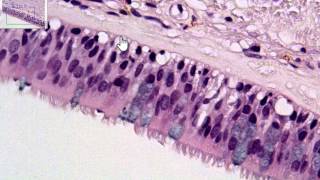 Pseudostratified Columnar P1 [upl. by Bridge318]