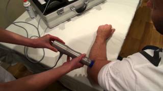 Tennis Elbow lateral epicondylitis Treatment with shockwave Zimmer enPuls [upl. by Ardekal]