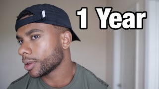 I Used Minoxidil For 1 Year  Heres What Happened [upl. by Moffitt]