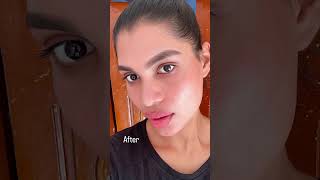 Full body peel jiore Transformation review Shop wwwjioreskinin [upl. by Barthelemy5]