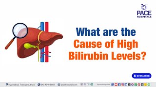 Cause of High Bilirubin Levels  What are the Cause of High Bilirubin Levels  Liverfunctiontest [upl. by Hamas598]