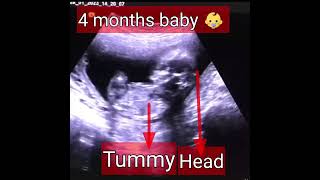 4monthfoetus shortsshortvideo16weekspregnant [upl. by Ruhtua585]