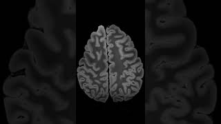 Brain Hemispheres Highest Resolution MRI 117 Tesla [upl. by Palm771]